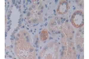 Detection of FKBP7 in Human Kidney Tissue using Polyclonal Antibody to FK506 Binding Protein 7 (FKBP7) (FKBP7 抗体  (AA 24-217))