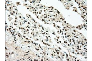 Image no. 1 for anti-TYRO3 Protein Tyrosine Kinase (TYRO3) antibody (ABIN1501608) (TYRO3 抗体)