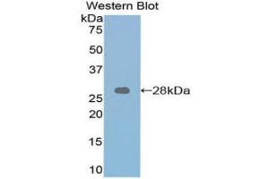Western Blotting (WB) image for anti-Retinoic Acid Receptor, alpha (RARA) (AA 237-459) antibody (ABIN1860407)