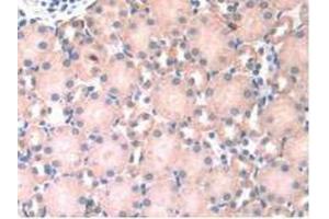 Detection of HPSE in Mouse Kidney Tissue using Polyclonal Antibody to Heparanase (HPSE)