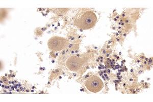 Immunohistochemistry (IHC) image for anti-C-Fos Induced Growth Factor (Vascular Endothelial Growth Factor D) (Figf) (AA 89-354) antibody (ABIN7431200)