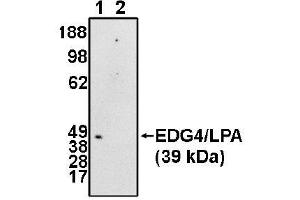 Image no. 1 for anti-Lysophosphatidic Acid Receptor 2 (LPAR2) (N-Term) antibody (ABIN265051) (EDG4 抗体  (N-Term))