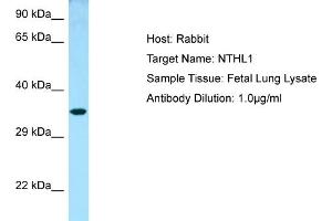 Western Blotting (WB) image for anti-Nth Endonuclease III-Like 1 (NTHL1) (N-Term) antibody (ABIN2789777) (Nth Endonuclease III-Like 1 (NTHL1) (N-Term) 抗体)