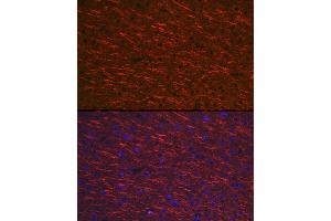 Immunofluorescence analysis of mouse brain cells using M Rabbit pAb (ABIN3016264, ABIN3016265, ABIN3016266, ABIN1680752 and ABIN6219676) at dilution of 1:100 (40x lens). (MAP2 抗体  (AA 260-559))