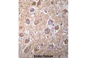Immunohistochemistry (IHC) image for anti-RAS Guanyl Releasing Protein 2 (Calcium and DAG-Regulated) (RASGRP2) antibody (ABIN2996572) (RASGRP2 抗体)