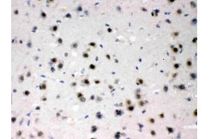 AZIN2 was detected in paraffin-embedded sections of mouse brain tissues using rabbit anti- AZIN2 Antigen Affinity purified polyclonal antibody (Catalog # ) at 1 µg/mL. (ADC 抗体  (AA 111-301))