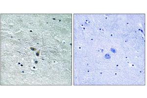 Immunohistochemistry analysis of paraffin-embedded human brain tissue using MAP3K8 (epitope around residue 400) antibody. (MAP3K8 抗体  (Ser400))