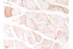 Immunohistochemistry (IHC) image for anti-serpin Peptidase Inhibitor, Clade A (Alpha-1 Antiproteinase, Antitrypsin), Member 10 (SERPINA10) (AA 278-425) antibody (ABIN7438085)