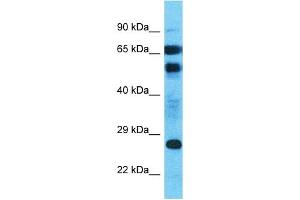 Host:  Rabbit  Target Name:  MLLT4-AS1  Sample Type:  Uterus Tumor lysates  Antibody Dilution:  1.