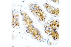 Immunohistochemistry of paraffin-embedded human stomach using SIRT1 antibody (ABIN5970059) at dilution of 1/100 (40x lens). (SIRT1 抗体  (C-Term))