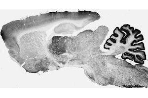 Adult rat brain immunohistochemistry. (Cav3.1 Ca2+ Channel (AA 2052-2172), (C-Term), (Cytosolic) 抗体)