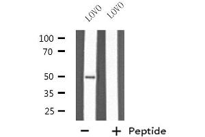 Western blot analysis of extracts from LOVO cells, using KRT37/38 antibody. (KRT37,38 抗体)