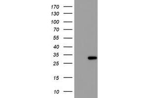 Western Blotting (WB) image for anti-Regulatory Factor X-Associated Ankyrin Containing Protein (RFXANK) antibody (ABIN1500685)