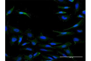 Immunofluorescence of purified MaxPab antibody to IL20RB on HeLa cell. (IL20RB 抗体  (AA 1-147))