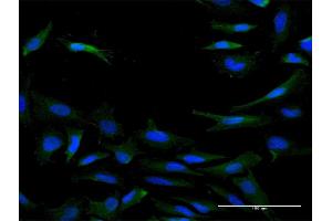 Immunofluorescence of purified MaxPab antibody to IL20RB on HeLa cell.