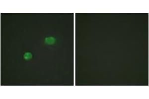 Immunofluorescence analysis of HeLa cells, using c-Jun (Ab-231) Antibody.