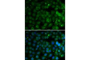 Immunofluorescence analysis of U20S cell using HPD antibody. (HPD 抗体)
