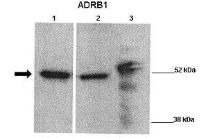 WB Suggested Anti-ADRB1 Antibody  Positive Control: Lane 1: 20ug Wild type mouse, left ventricle Lane 2: 20ug Transgenic mouse, treated with experimental drug, left ventricle Lane 3: 20ug HepG2 lysate  Primary Antibody Dilution :  1:1000 Secondary Antibody : Goat anti rabbit-HRP  Secondry Antibody Dilution :  1:5,000 Submitted by: Kathleen Gabrielson