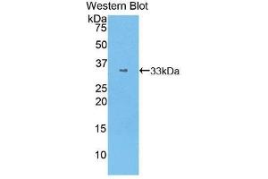 Western Blotting (WB) image for anti-Signal Transducer and Activator of Transcription 1, 91kDa (STAT1) (AA 343-602) antibody (ABIN3206143) (STAT1 抗体  (AA 343-602))