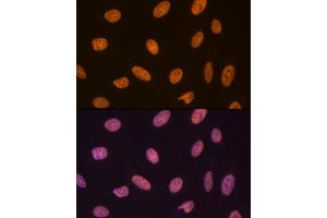 Immunofluorescence analysis of U-2 OS cells using SET/T Rabbit mAb (ABIN7270265) at dilution of 1:100 (40x lens). (SET/TAF-I 抗体)