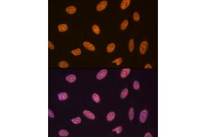 Immunofluorescence analysis of U-2 OS cells using SET/T Rabbit mAb (ABIN7270265) at dilution of 1:100 (40x lens). (SET/TAF-I 抗体)
