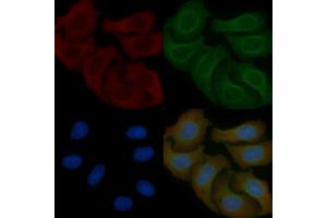 ZER1 Mouse Monoclonal Antibody staining Hela cells by IF/ICC. (ZER1 抗体)