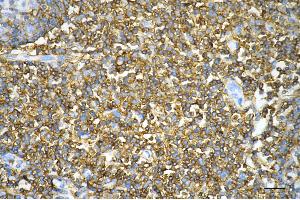 Immunohistochemistry was performed on paraffin-embedded human tonsillitis using CD44 antibody (ABIN7797973), 1:200). (Recombinant CD44 抗体)