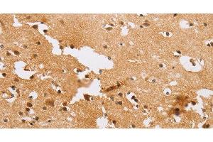 Immunohistochemistry of paraffin-embedded Human brain tissue using ACTR2 Polyclonal Antibody at dilution 1:40 (ACTR2 抗体)