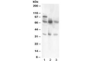 Western blot testing of GAD67 antibody and Lane 1:  rat brain;  2: human HeLa;  3: (h) COLO320. (GAD 抗体  (AA 14-122))