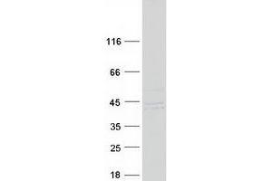 Western Blotting (WB) image for Phosphotriesterase Related (PTER) (Transcript Variant 1) protein (Myc-DYKDDDDK Tag) (ABIN2730059)
