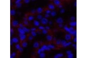 Immunofluorescence analysis of Rat kidney tissue using JAK3 Polyclonal Antibody at dilution of 1:200. (JAK3 抗体)
