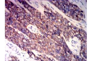 Immunohistochemistry (IHC) image for anti-CD99 (CD99) (AA 1-185) antibody (ABIN7193657)