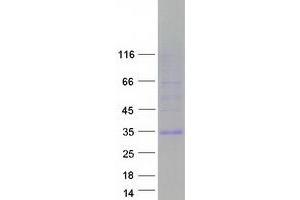 Validation with Western Blot