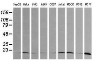 Image no. 2 for anti-HRas proto-oncogene, GTPase (HRAS) antibody (ABIN1498713) (HRAS 抗体)