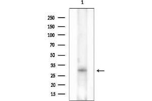 anti-Melanoma Antigen Family F, 1 (MAGEF1) (Internal Region) antibody