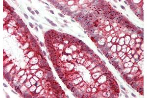 Immunohistochemistry (IHC) image for anti-Solute Carrier Family 39 (Metal Ion Transporter), Member 5 (SLC39A5) (N-Term) antibody (ABIN2781736)