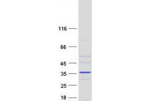 Validation with Western Blot