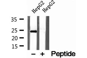 Western blot analysis of extracts of HepG2 cells, using Cyclophilin B antibody. (PPIB 抗体  (C-Term))