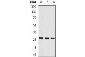 Western blot analysis of UBE2J2 expression in Hela (A), mouse testis (B), mouse brain (C) whole cell lysates. (UBE2J2 抗体)