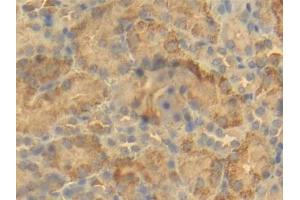DAB staining on IHC-P; Samples: Mouse Kidney Tissue (BCL2L1 抗体  (AA 2-212))