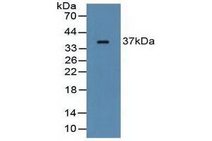 Western blot analysis of Rat Serum. (FCN1 抗体  (AA 25-279))