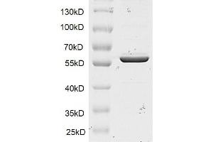 Recombinant SMYD1 protein gel. (SMYD1 Protein (DYKDDDDK Tag))