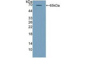 Detection of Recombinant PRF1, Mouse using Polyclonal Antibody to Perforin 1 (PRF1) (Perforin 1 抗体  (AA 40-355))