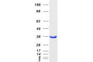 Western Blotting (WB) image for Microtubule-Associated Protein, RP/EB Family, Member 1 (MAPRE1) protein (Myc-DYKDDDDK Tag) (ABIN2725473)