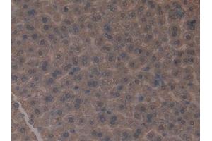 Detection of GLUD1 in Mouse Liver Tissue using Polyclonal Antibody to Glutamate Dehydrogenase 1 (GLUD1) (GLUD1 抗体  (AA 65-273))