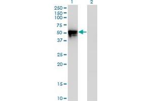 Western Blot analysis of KLF8 expression in transfected 293T cell line by KLF8 monoclonal antibody (M12), clone 3F10. (KLF8 抗体  (AA 1-98))