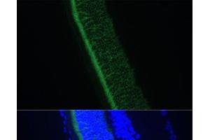 Immunofluorescence analysis of Rat eye using GNGT1 Polyclonal Antibody at dilution of 1:100 (40x lens). (GNGT1 抗体)
