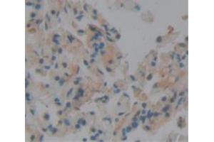 Used in DAB staining on fromalin fixed paraffin- embedded Kidney tissue (WNT2B 抗体  (AA 62-391))