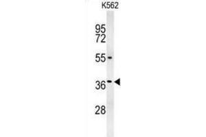 Western Blotting (WB) image for anti-Glucagon-like peptide 1 (GLP-1) antibody (ABIN3002369) (GLP-1 抗体)