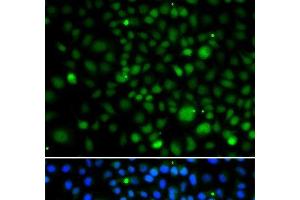 Immunofluorescence analysis of A549 cells using KLF15 Polyclonal Antibody (KLF15 抗体)